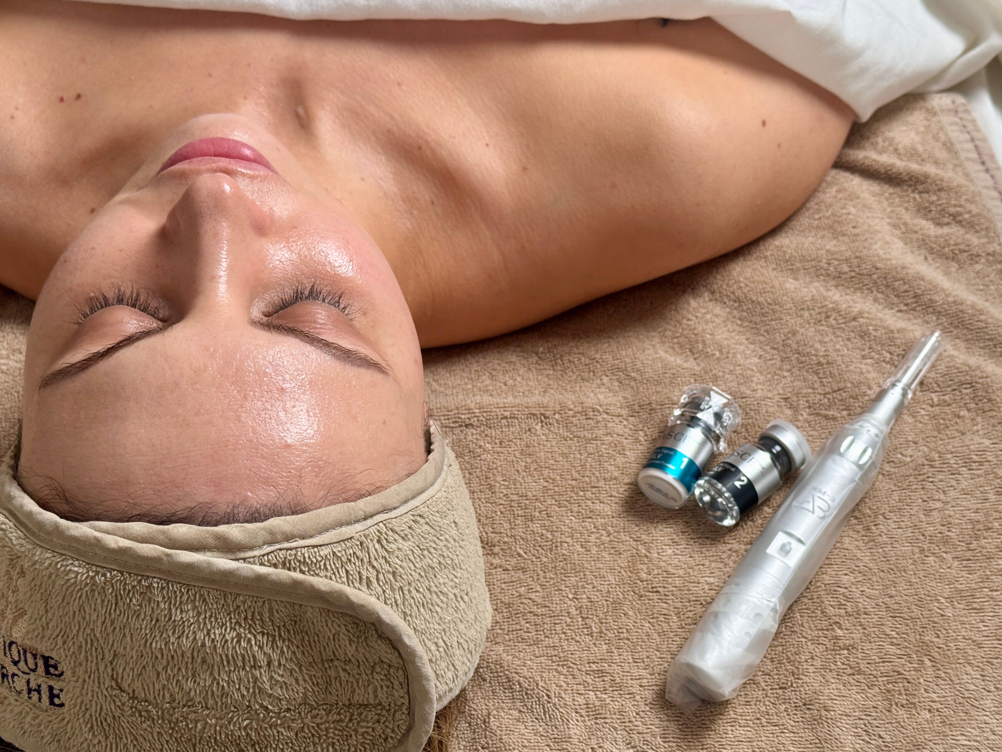 Exosomes with Microneedling: Everything You Need to Know