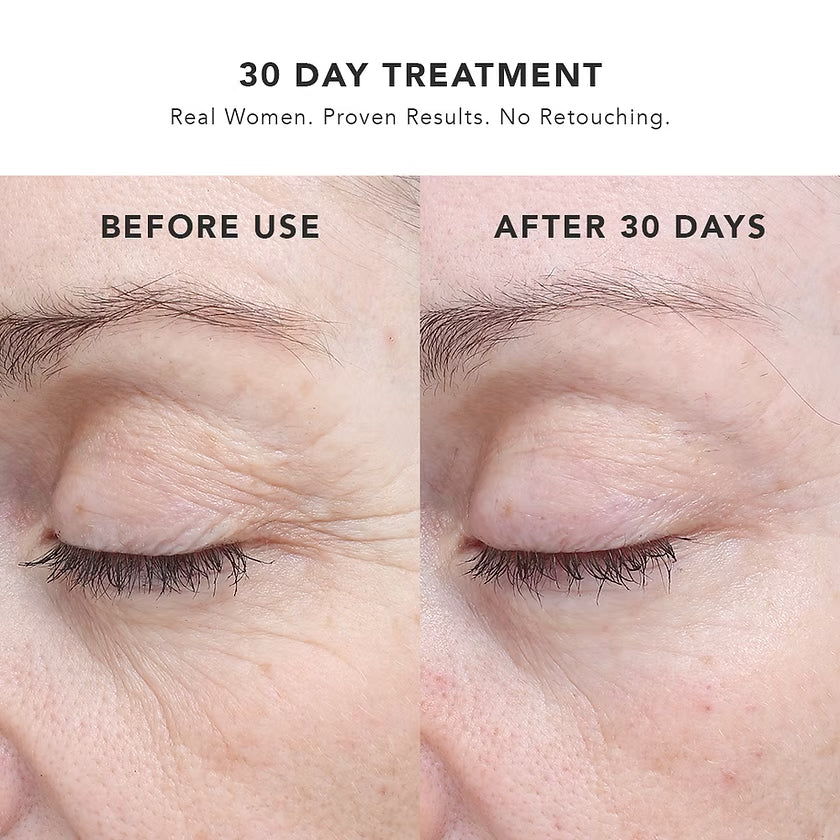 BIOEFFECT 30 DAY TREATMENT