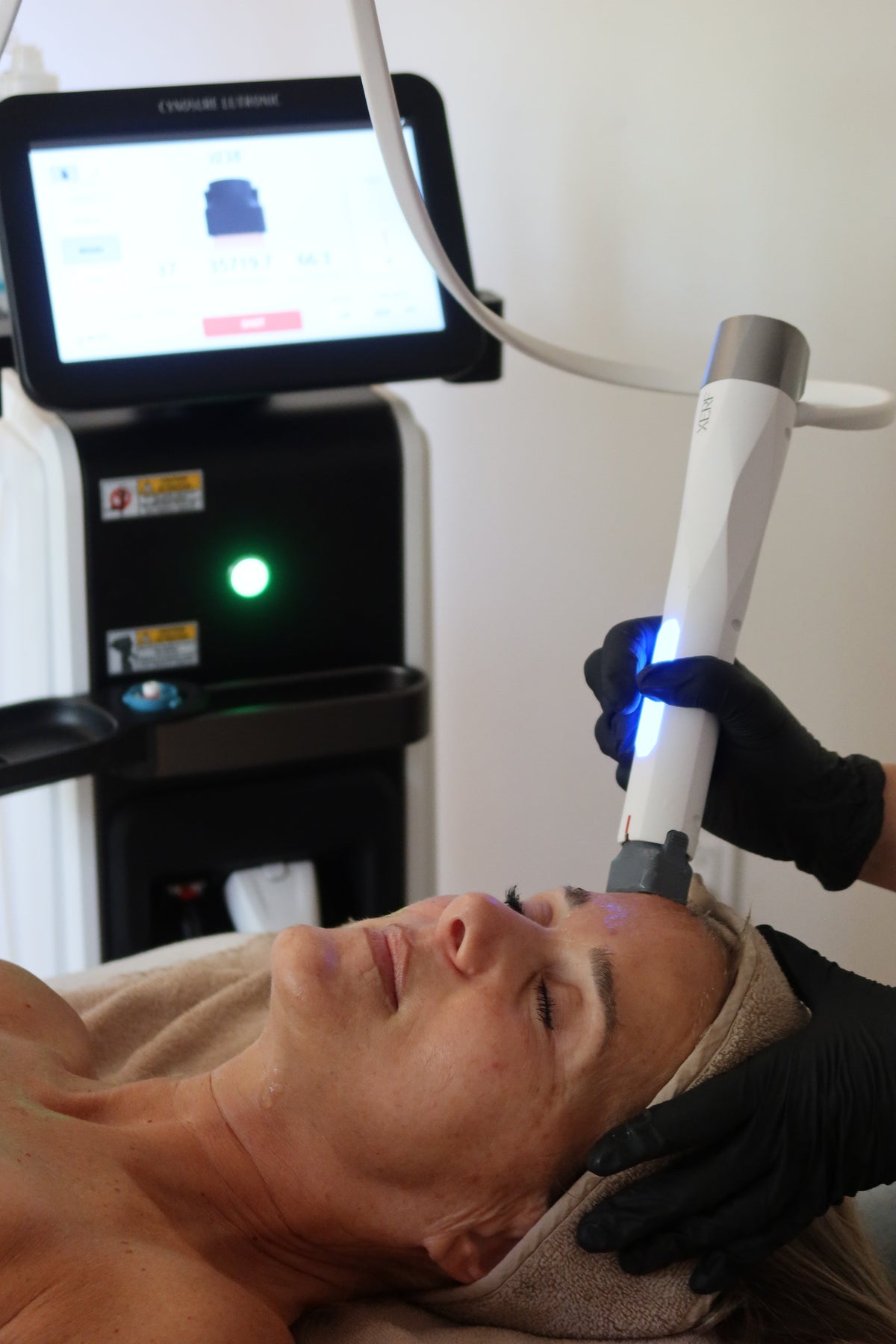 XERF vs Thermage, Morpheus8 & Ultherapy: A Clear Guide to Skin Tightening in Toronto
