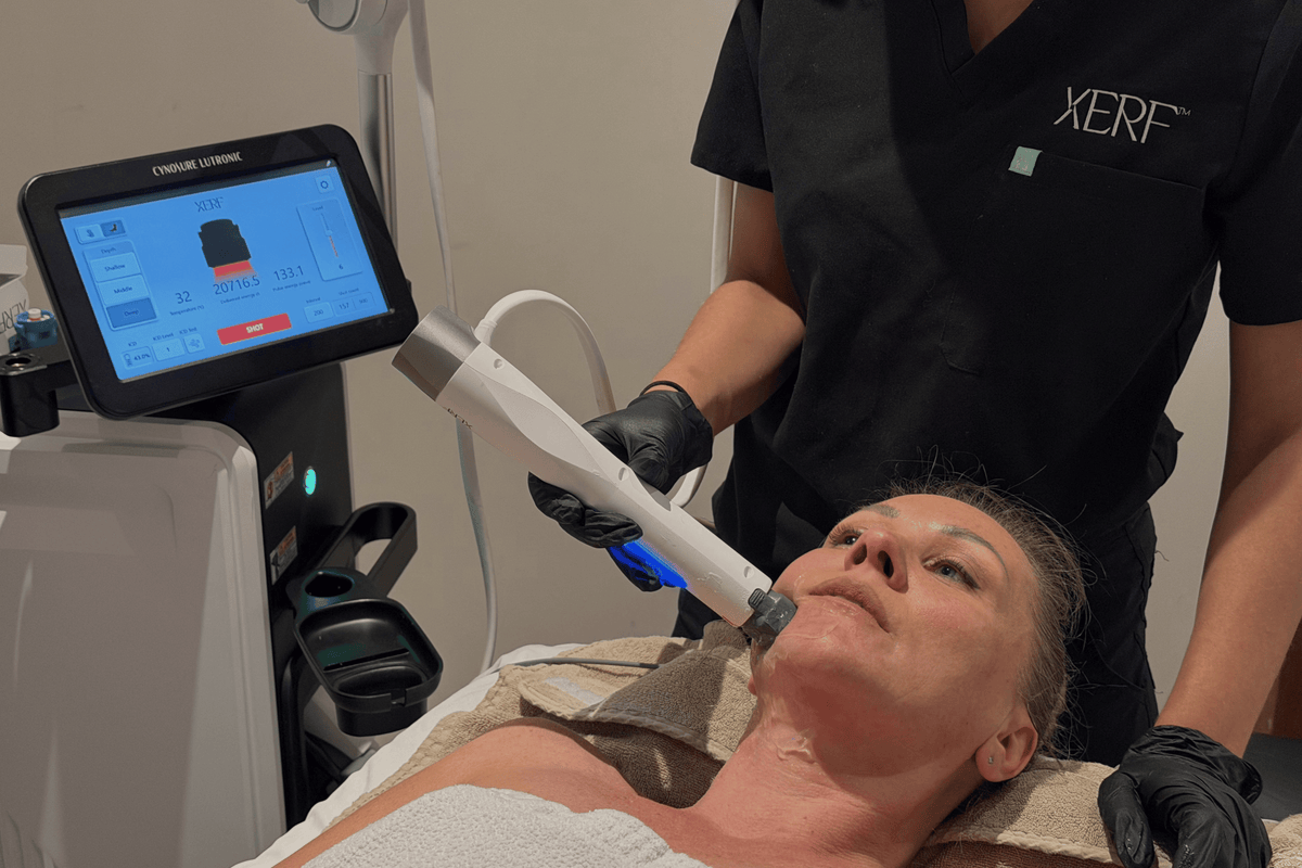 XERF™ Structural Skin Tightening: Everything You Need to Know