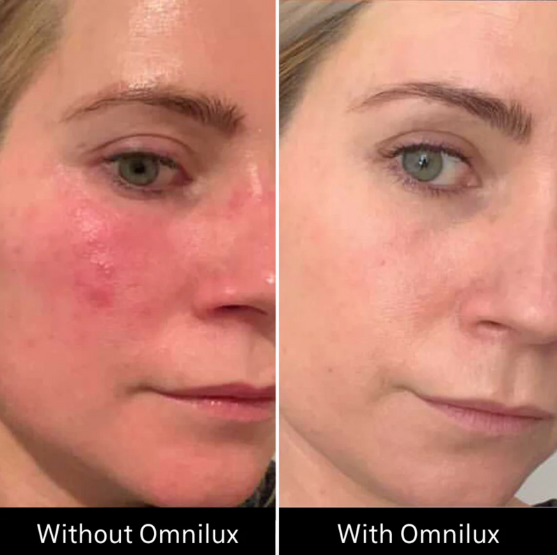 Omnilux Contour Face