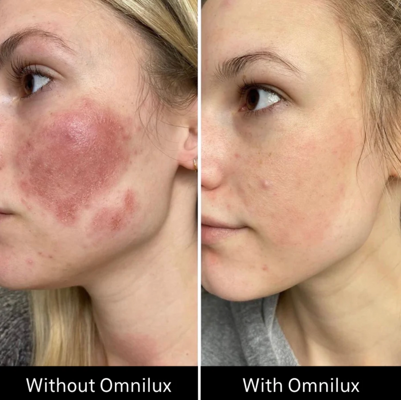 Omnilux Contour Face